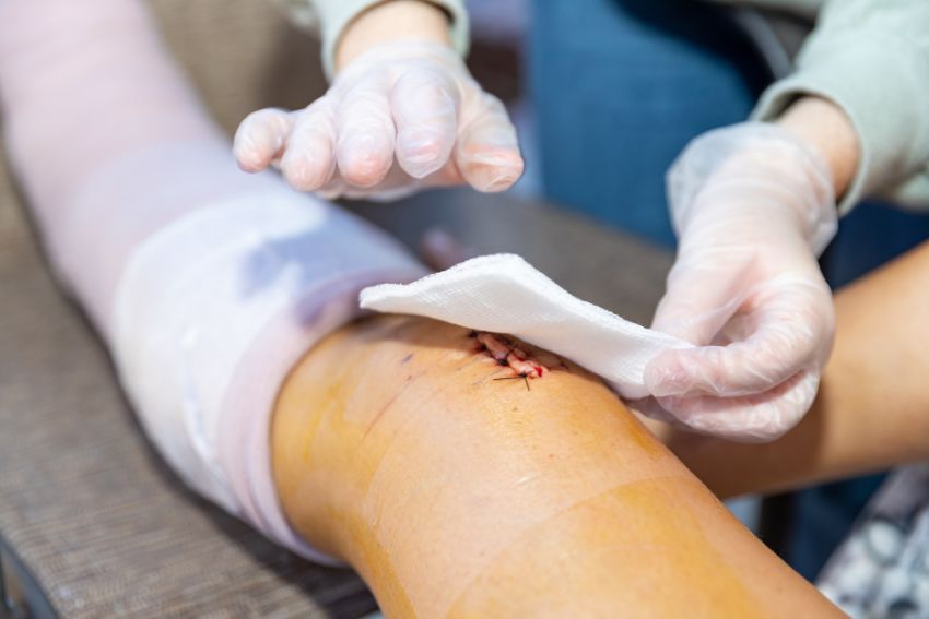 Post-Surgery Rehabilitation for Faster Recovery and Mobility Restoration.